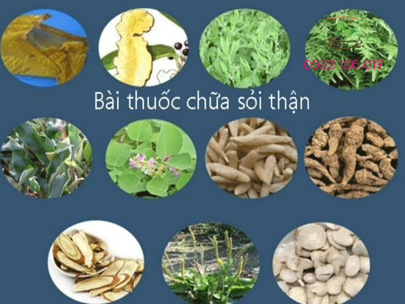 Cây thuốc nam trị sỏi thận