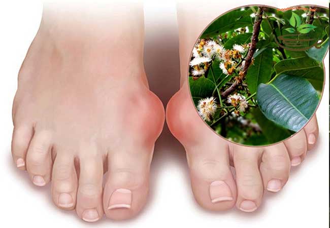nụ vối trị gout