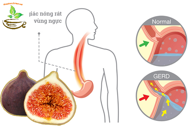 Trị đau dạ dầy, trào ngược dạ dầy từ quả sung- trái sung