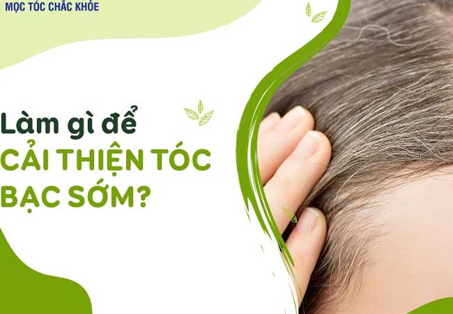 tóc bạc sớm