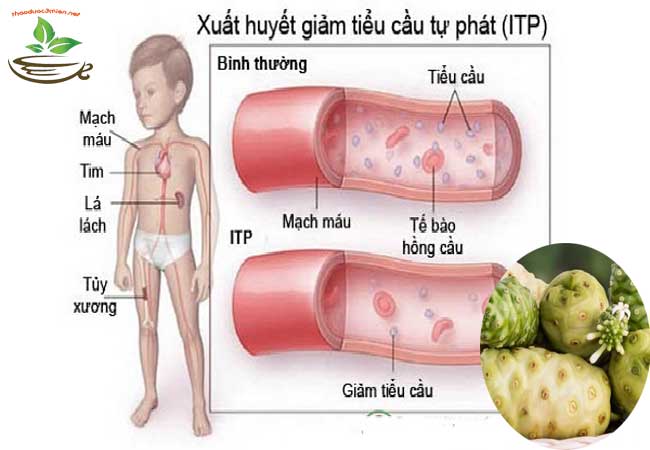 trái nhàu trị bệnh giảm tiểu cầu